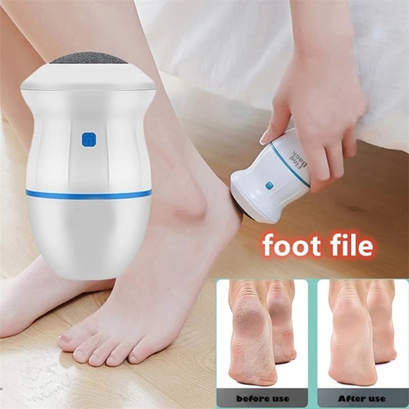 Callus Remover by Danish Rehman