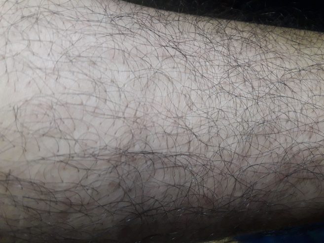 Body hair removing service home. by Basheer Chali