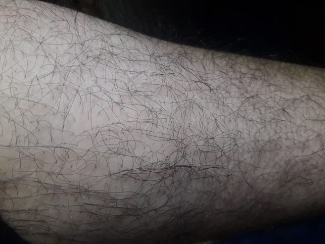 Body hair removing service home. by Basheer Chali