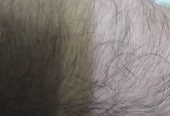 Body hair removing service home. by Basheer Chali