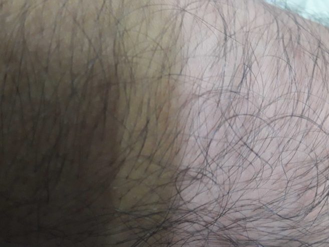 Body hair removing service home. by Basheer Chali
