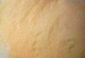 “MEMON MARBLE POLISH” by Zaraar Zaraar