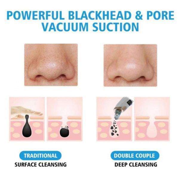 Black head remover skin care cash on delivery available by Waseem Raza
