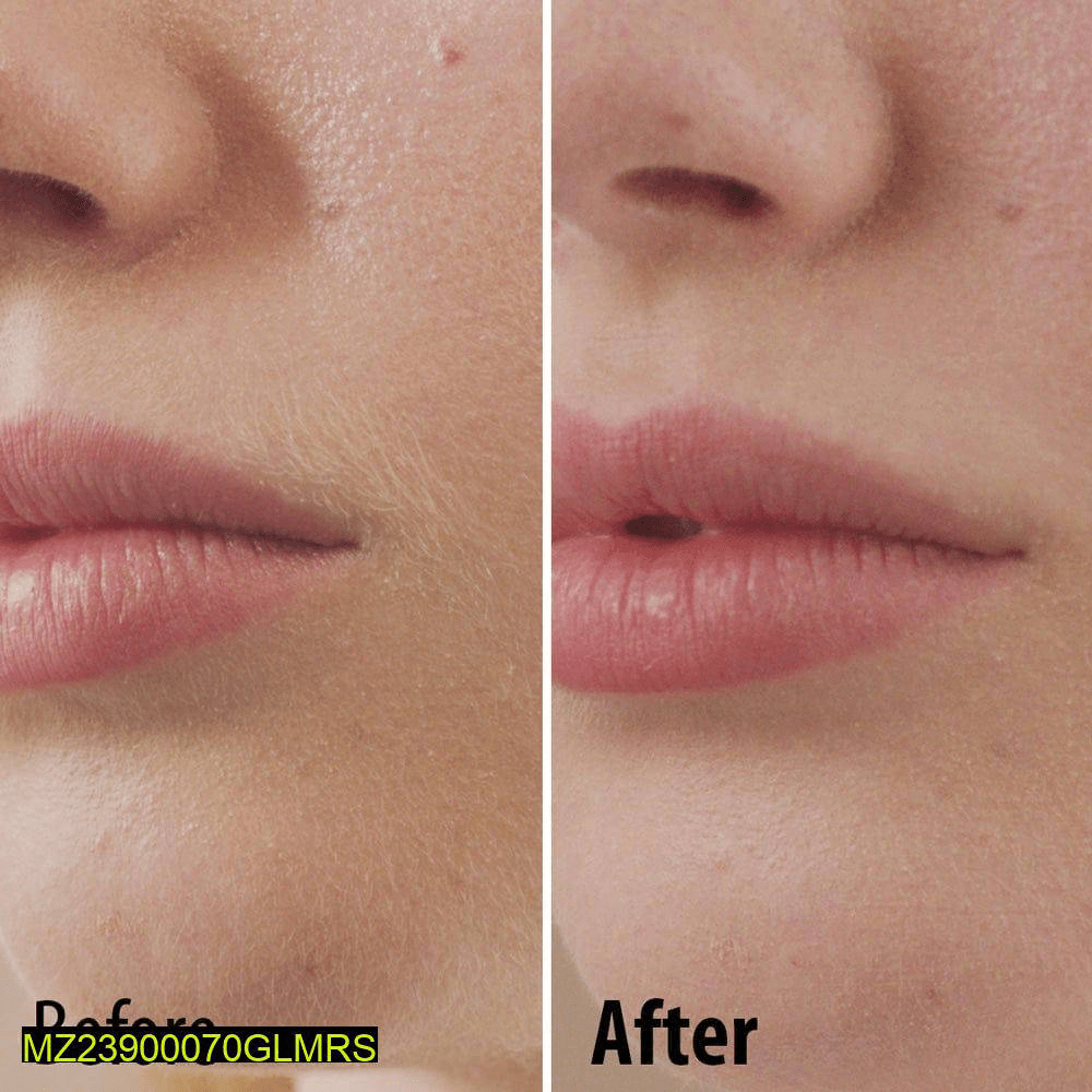 Hair removal by Muhammad Kabeer