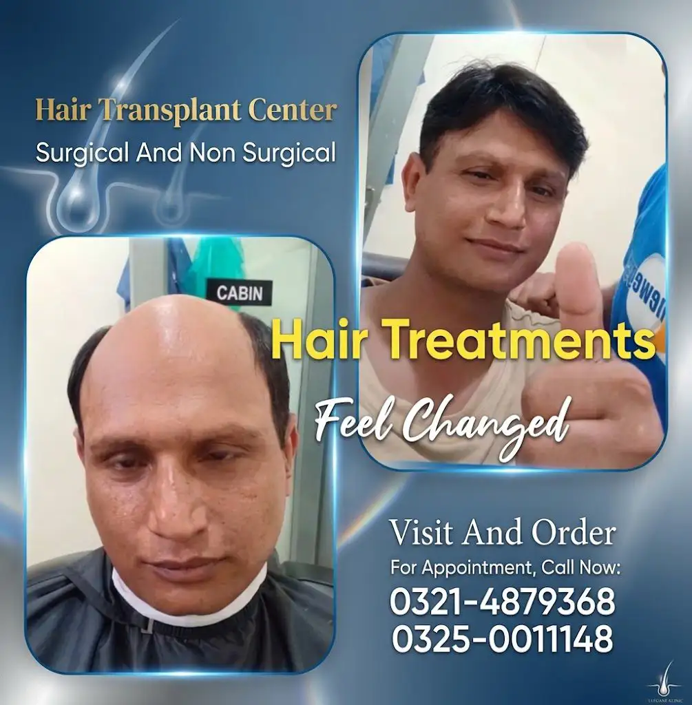 Hair Patch, hair wig, hair unit, hair extensions, hair cap