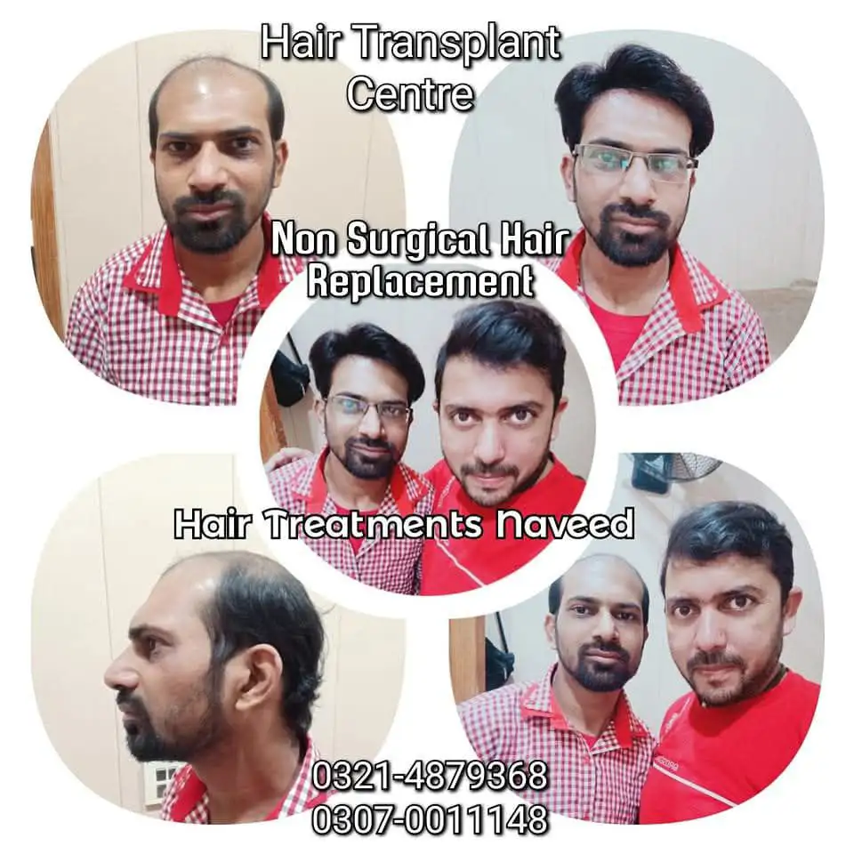 Hair wig , hair patch , hair extensions , hair cap